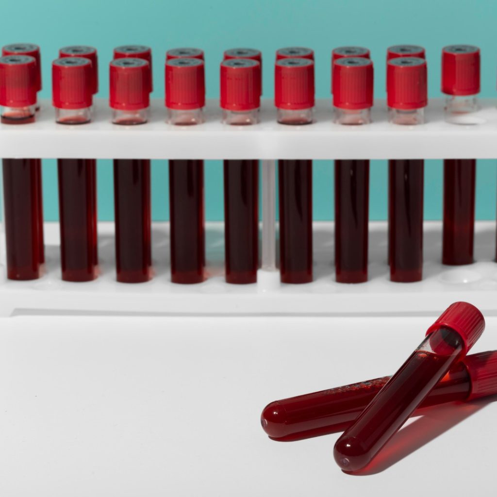 blood sample courier UK